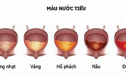 Nước Có Màu Đỏ